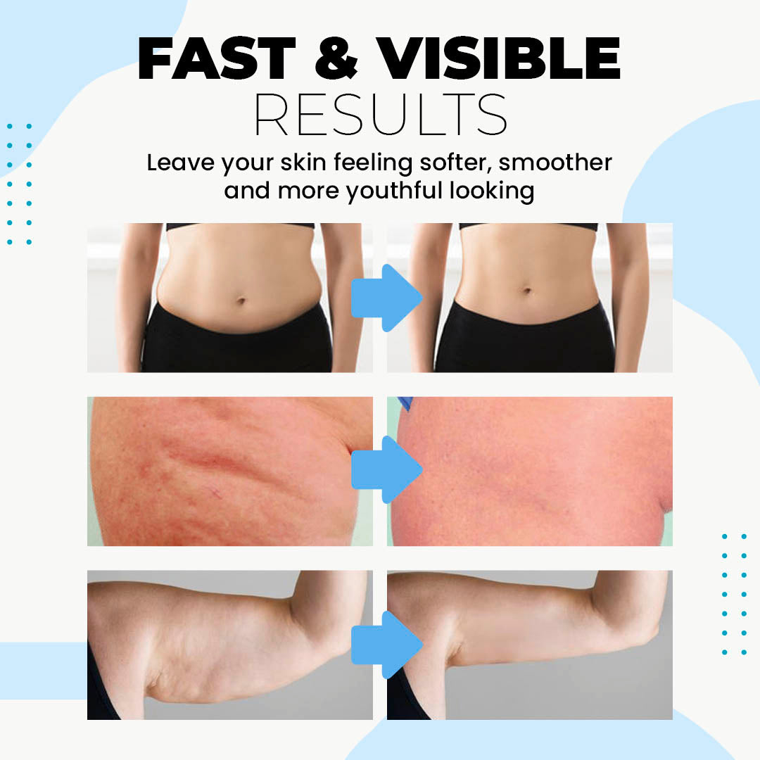 LBMLAB Collagen Essence Tightening Patch 🔥— Restores Skin Firmness & Fades Wrinkles in Weeks