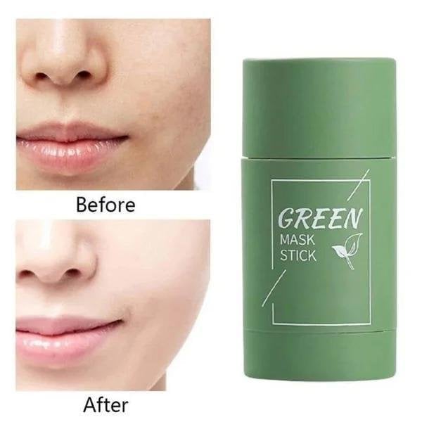 Last Day 75% OFF 🔥🍵Buy 1 Get 1 Free🍵 Deep Cleanse Green Tea Mask