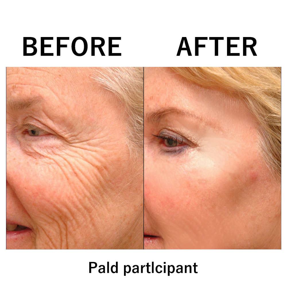 Final 3 Hours: 80%OFF🔥Instant Temporary Face Tightener