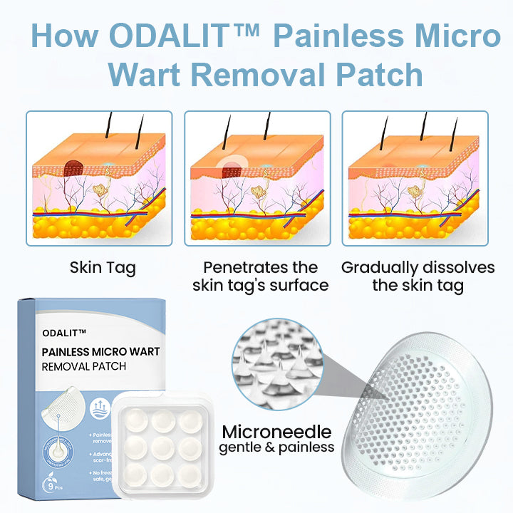 ODALIT™ Painless Nano Wart Removal Patch