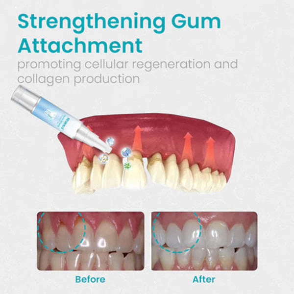 🔥Last Day 69% OFF-SEURICO™ Gum Shield Therapy Gel