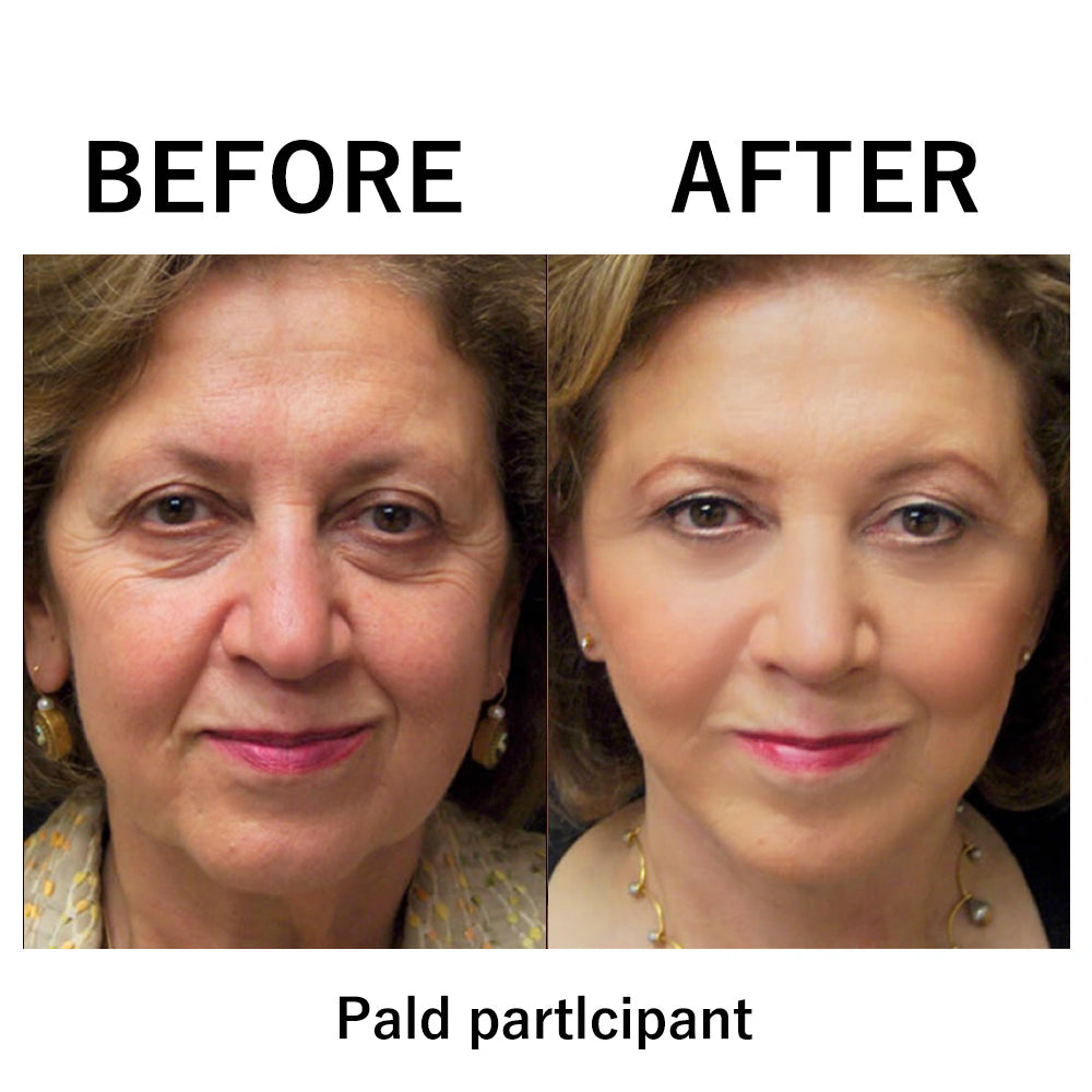 Final 3 Hours: 80%OFF🔥Instant Temporary Face Tightener