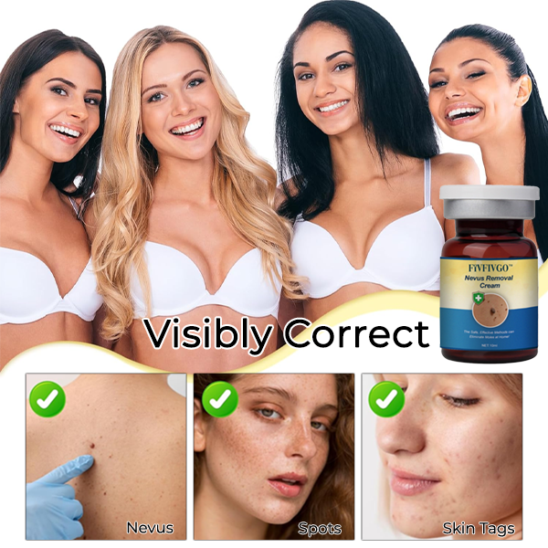 Seurico™ Nevus Removal Cream