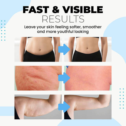 LBMLAB Collagen Essence Tightening Patch 🔥— Restores Skin Firmness & Fades Wrinkles in Weeks