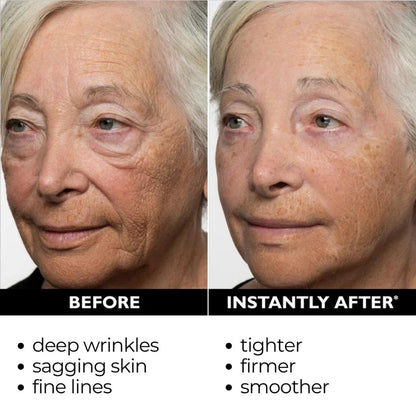 Final 3 Hours: 80%OFF🔥Instant Temporary Face Tightener