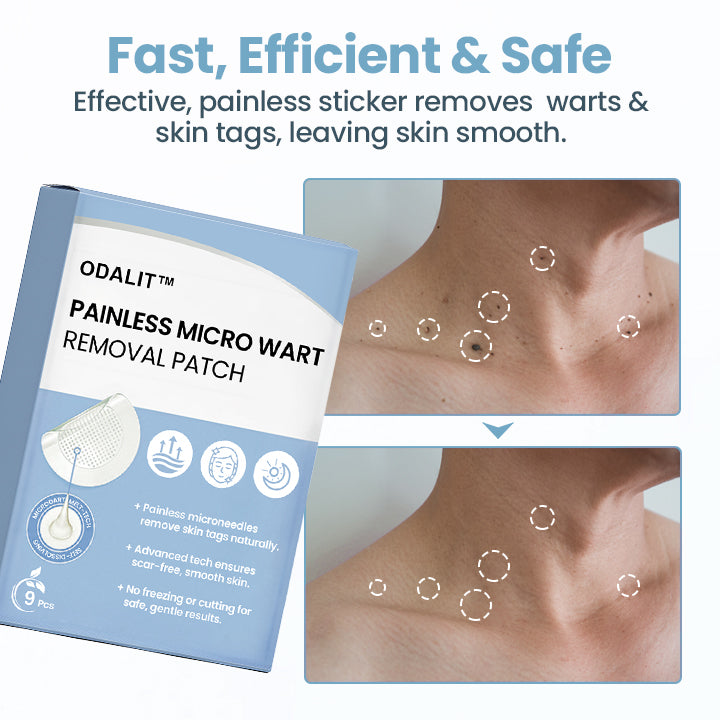 ODALIT™ Painless Nano Wart Removal Patch