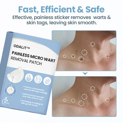 ODALIT™ Painless Nano Wart Removal Patch