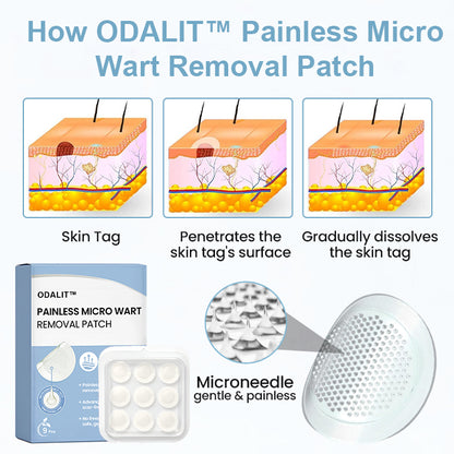 ODALIT™ Painless Nano Wart Removal Patch